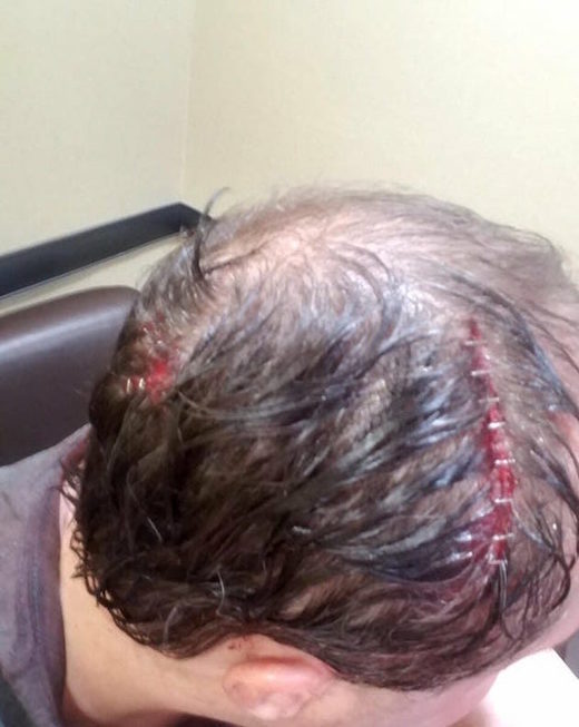 Ohio Trump supporter attacked