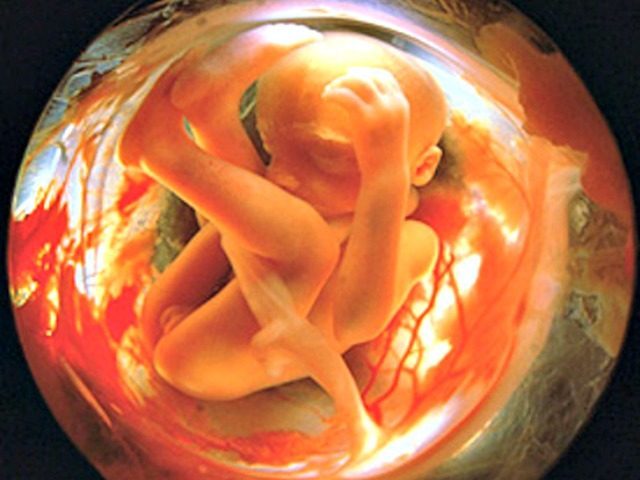 Click to enlarge fetus