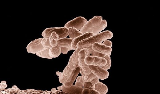 Ecoli