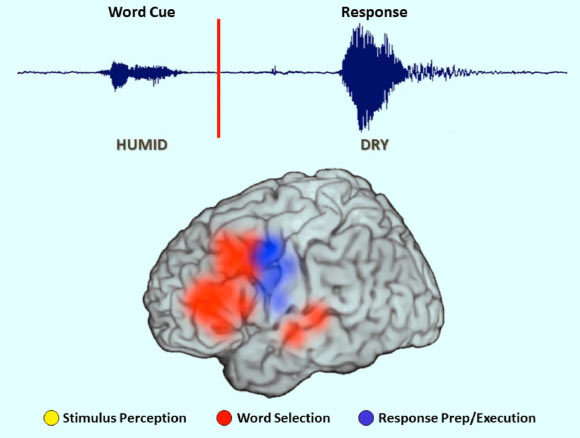 Click to enlarge Brain area stimulation