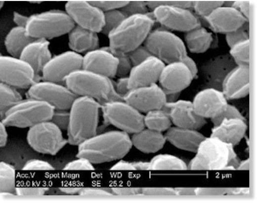 Anthrax spores under microscope