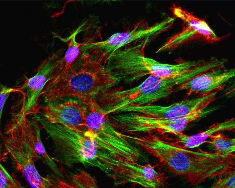 Click to enlarge blood cells