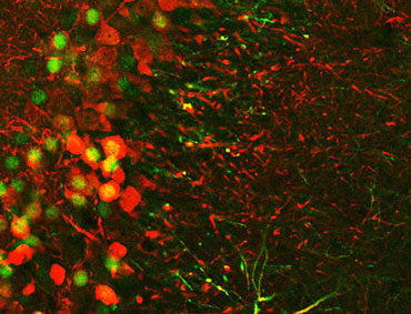 Click to enlarge Brain Memories 7