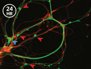 Click to enlarge Brain Memories 4