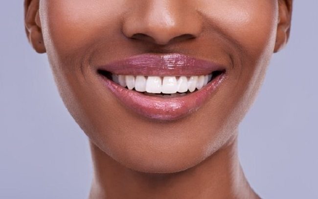 Click to enlarge Teeth