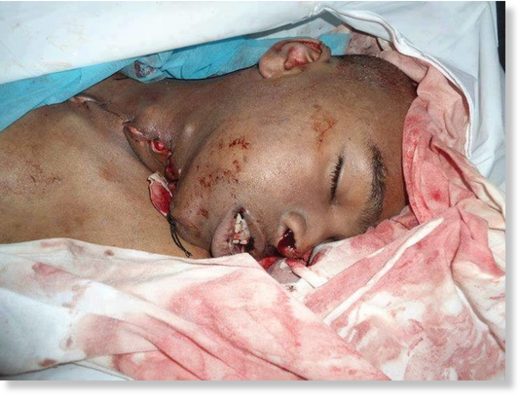 Young Tawergha tortured