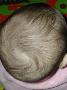 Click to enlarge hair whorls