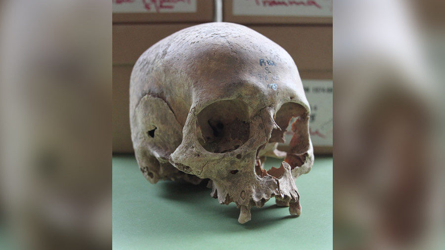 skull