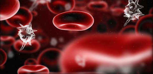 Click to enlarge sepsis