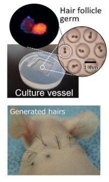 Click to enlarge hair folicle generation