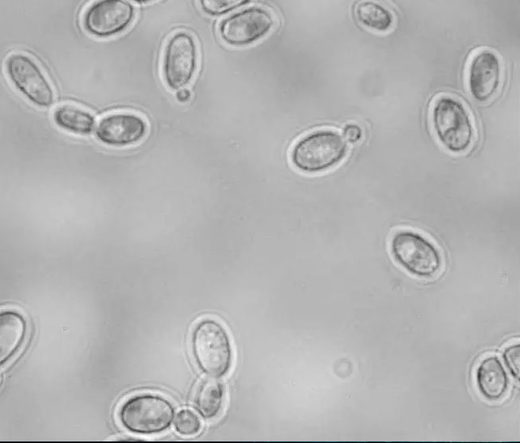yeast