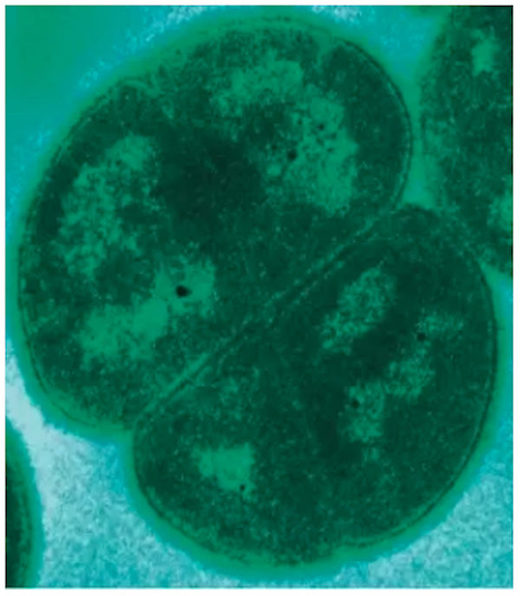 Click to enlarge yeast