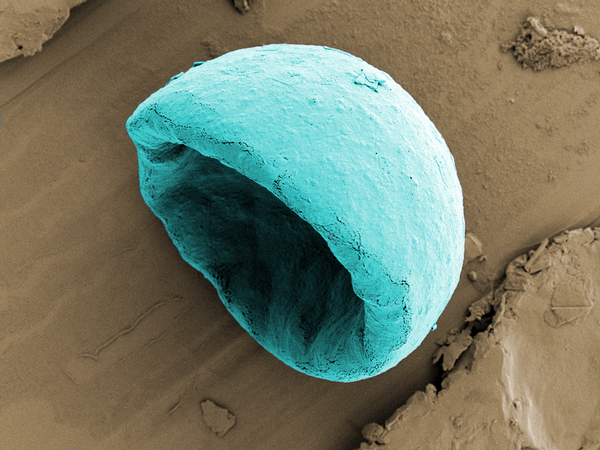 Click to enlarge 'Biodegradable microbowls could help fight stubbon cancers' by Tayo Sanders II, University of Oxford