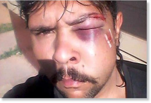 Joshua Hayden, 19, was out with his brother when the animal attacked