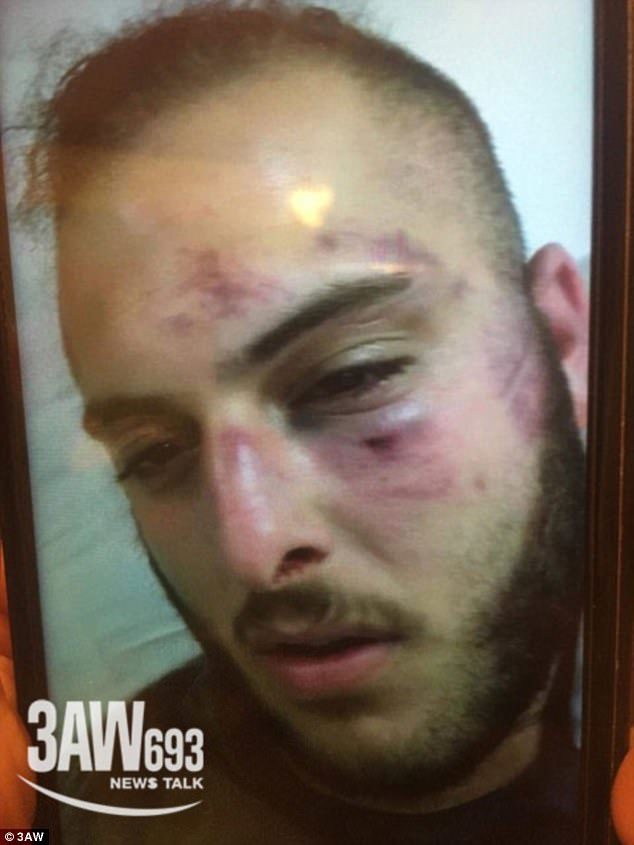 Click to enlarge Video filmed on a guest's mobile phone shows both male and female passengers erupt into an all-in brawl as cruise security attempted to intervene, leaving some victims with savage bruises and cuts