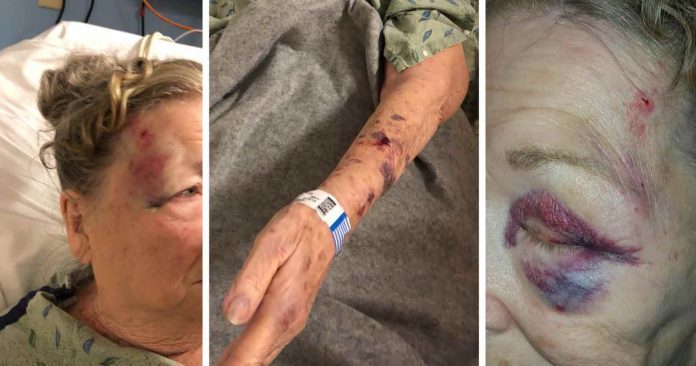 Arizona grandmother attacked cops