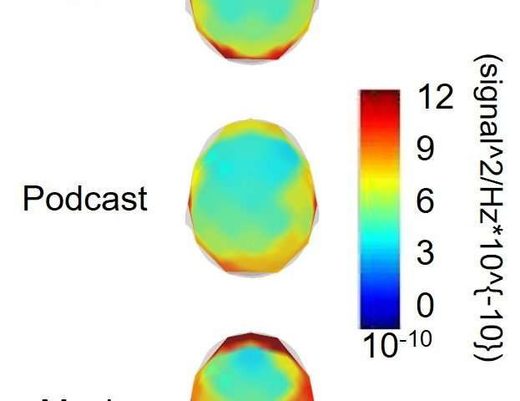 Click to enlarge brain scans music exercise
