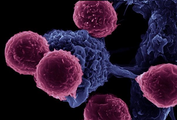 Click to enlarge t-cell electron microscope
