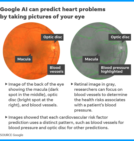 Google AI heart problems