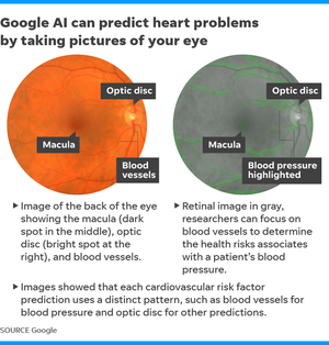 Problemas del corazón de Google AI