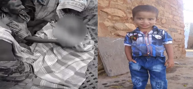 Kurnool: Four-year-old boy killed in stray dog attack