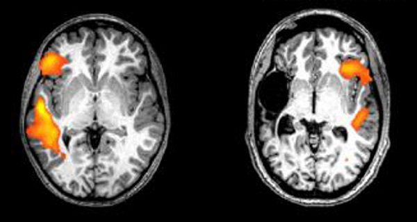 Click to enlarge MRI of human brain