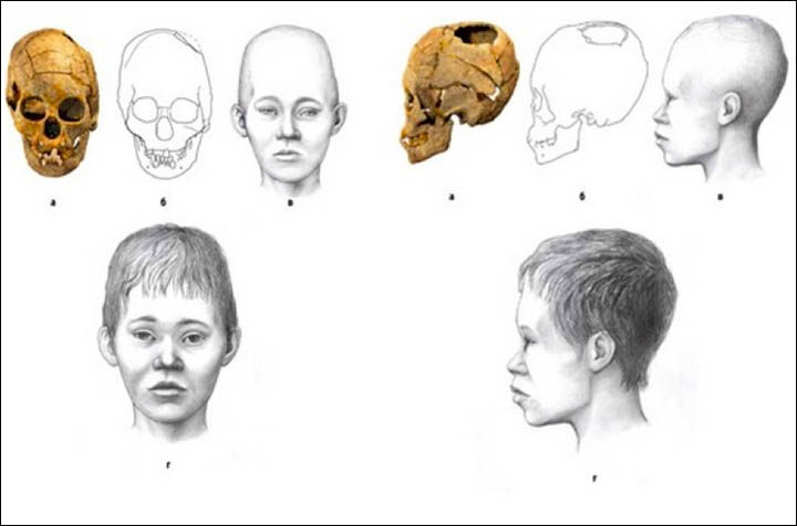 siberia trepanation