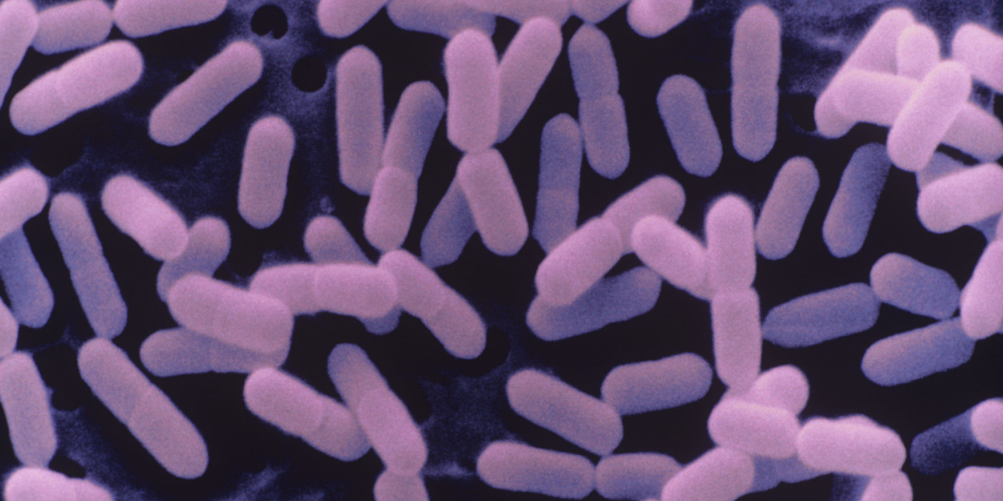 Click to enlarge listeria
