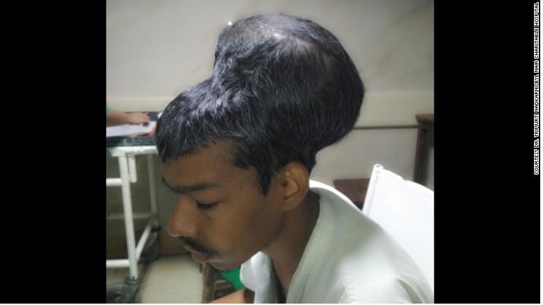 Click to enlarge massive brain tumour
