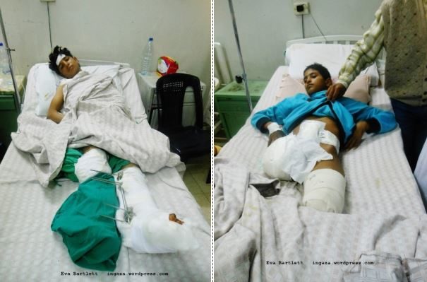 Click to enlarge Syrian boys in the hospital
