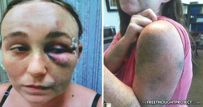 Click to enlarge woman beaten by police