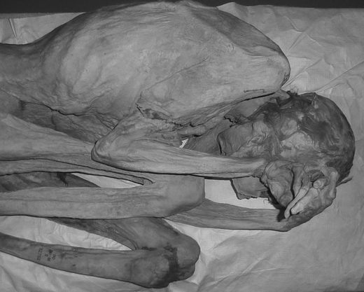 The female Gebelein woman was also examined under infrared light.