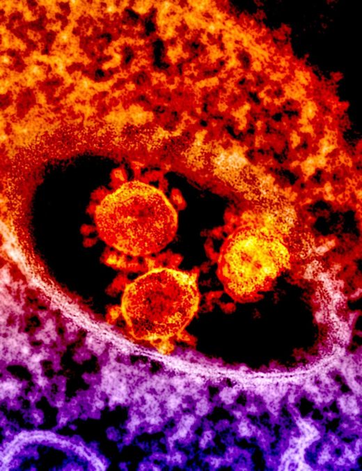 coronavirus