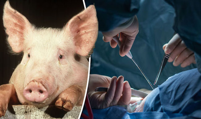 pig human organ transplants