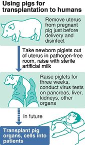 pig organs human transplant