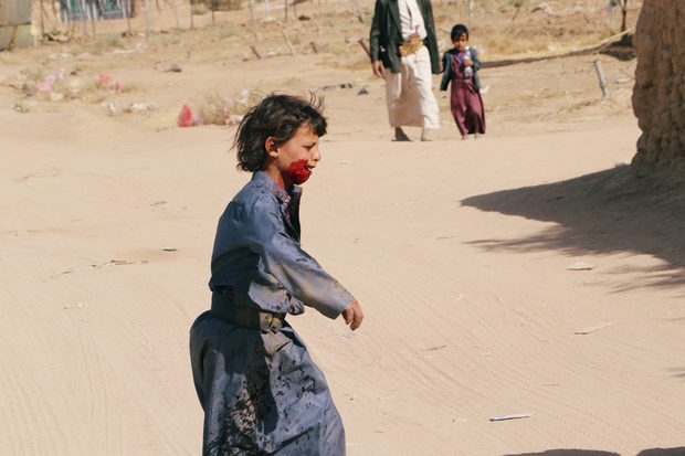 injured boy Yemen