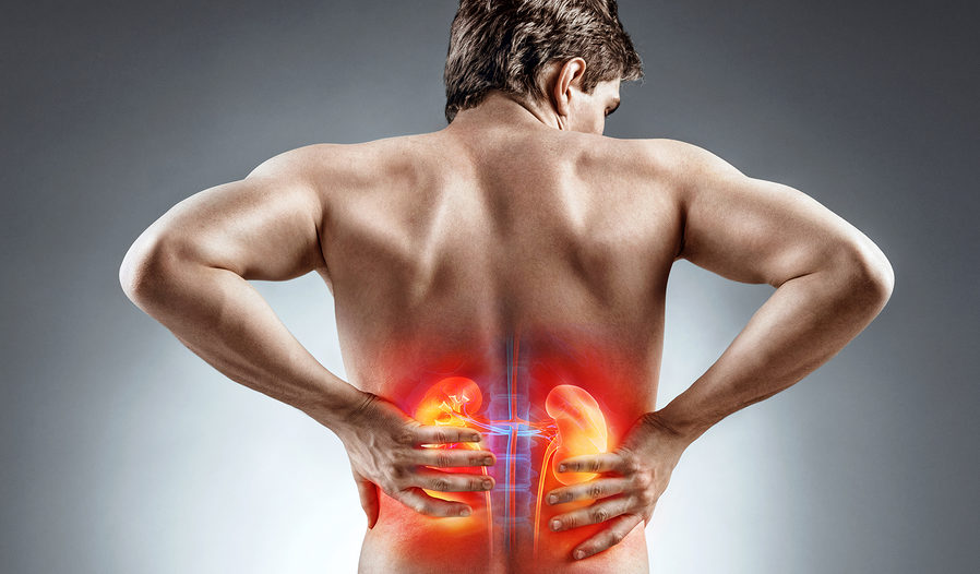 kidney stones