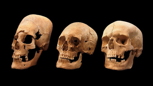 Specimens with strong (left), some (middle) and no (right) skull deformation.