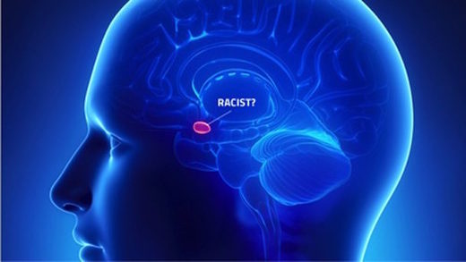 Click to enlarge unconscious bias amygdala