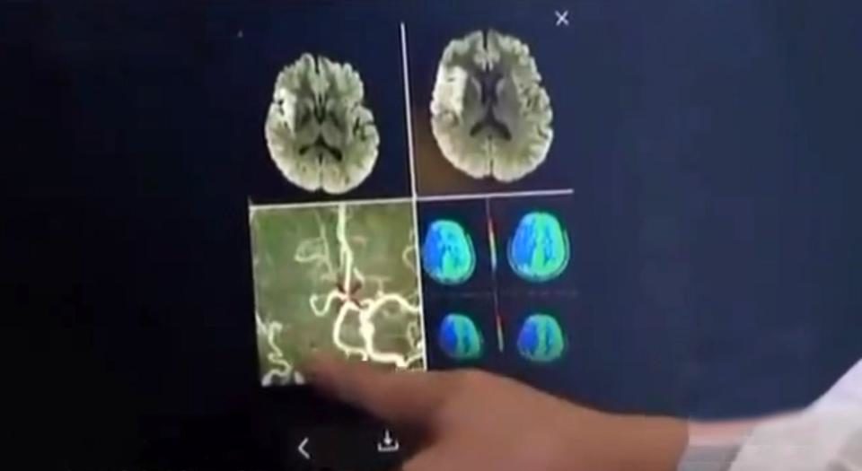 Click to enlarge CAT scan