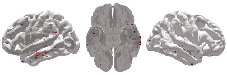 Click to enlarge brain stimulation