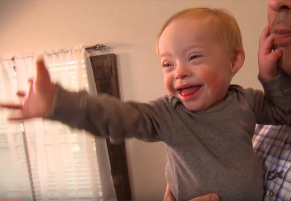 Lucas Warren Down's syndrome
