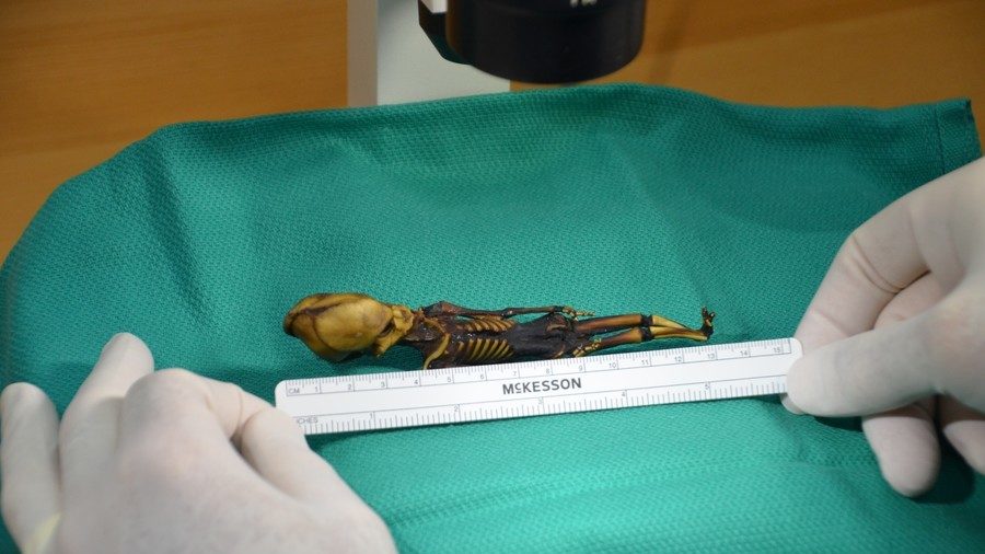 Click to enlarge Skeleton