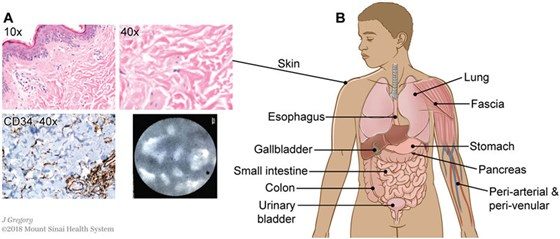 interstitium nestles into inside the human body.