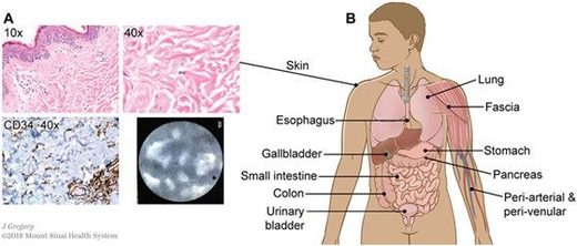 Click to enlarge interstitium nestles into inside the human body.
