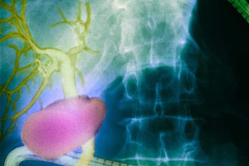 Fluid-filled channels may cushion our organs