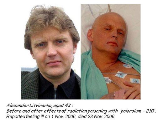 Alexander Litvinenko before  after