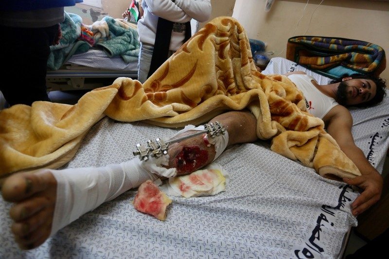 Muslih Sheikh Khalil, 24, is treated at Gaza City’s al-Shifa hospital