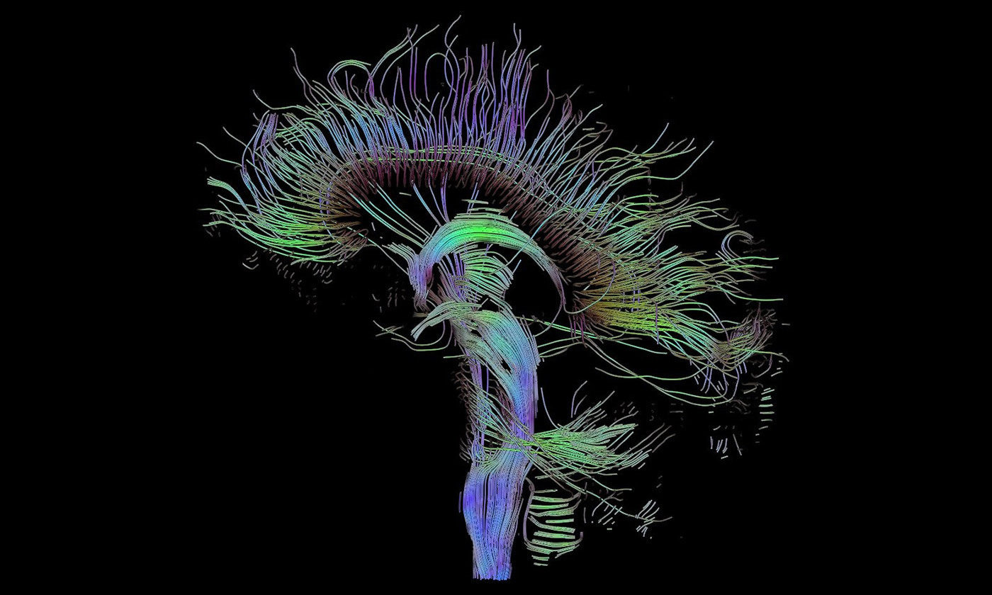 Brain