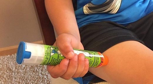 The Peanut Allergy Epidemic
